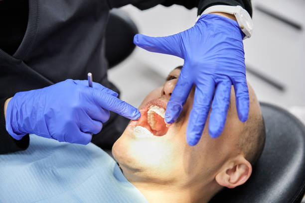 Best Knocked-Out Tooth Emergency  in Wildwood Crest, NJ